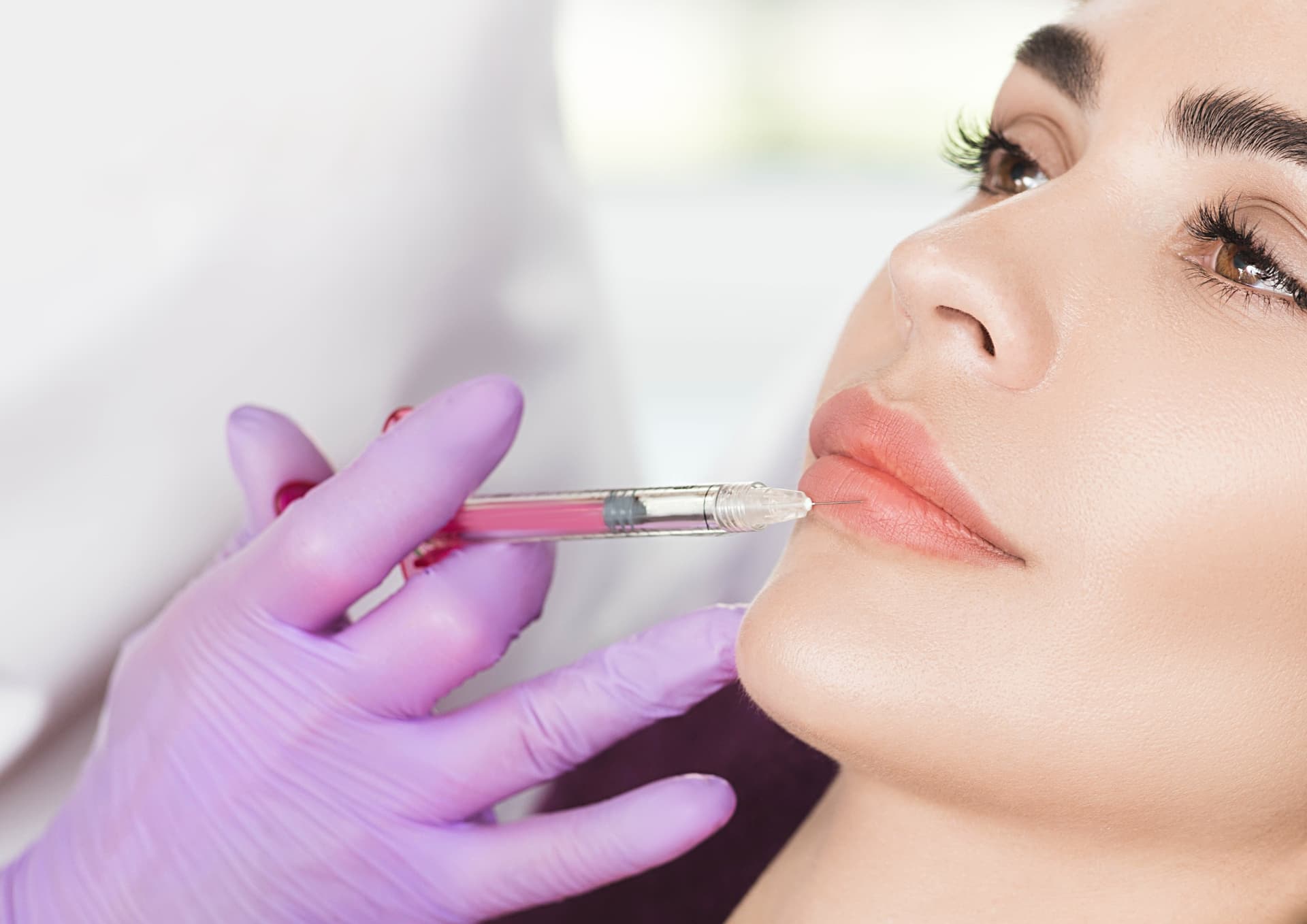 Lippen Aufspritzen Nürnberg: Die besten Methoden für volle Lippen