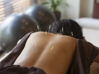 Akupunktura a lelki egyensúly támogatásában – Akupunkturbehandlungen usw tapasztalata