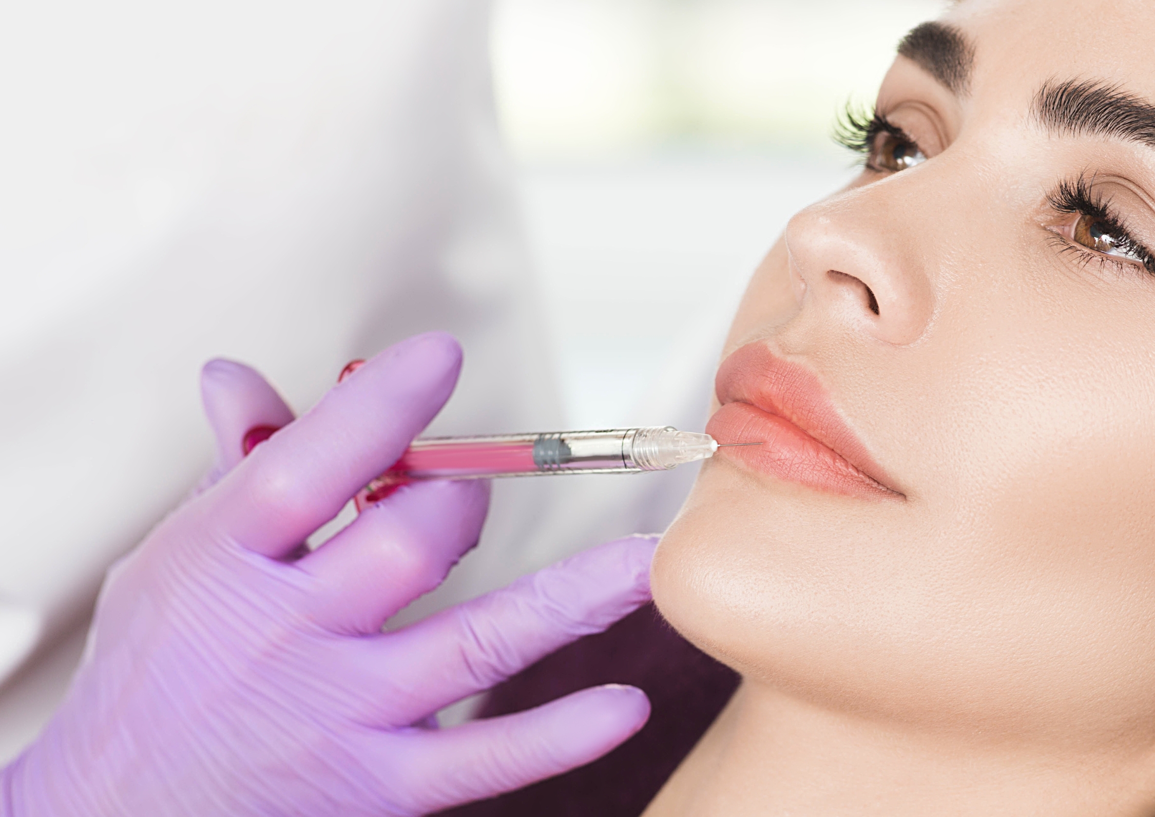 Lippen Aufspritzen Nürnberg: Die besten Methoden für volle Lippen